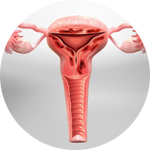 Adenomyosis 