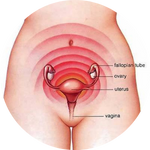 Dysmenorrhea
