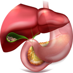 Gallbladder Stone